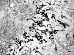 Thumbnail of Presence of numerous, broad (3−9 μm in diameter), irregular, septate hyphae in a pyogranulomatous dermatitis (Gomori methenamine silver stain). Bar = 15 μm.