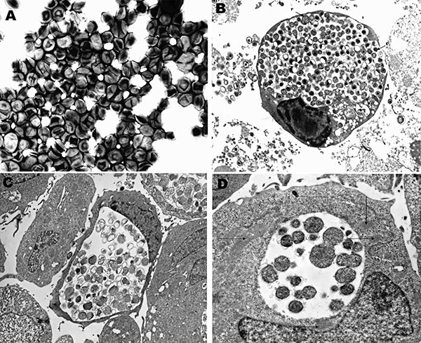 A, Negative stain electronmicrograph of Waddlia malaysiensis elementary bodies. B–D, Thin-section electronmicrographs of cells infected with W. malaysiensis. B, large inclusion with elementary(e) and reticulate(r) bodies in HEK cells 72 h postinfection. C, a large inclusion in EBV-transformed human B-lymphocytes. D, dividing reticulate bodies in HEK cells 48 h postinfection in an inclusion with numerous surrounding mitochondria (arrow).