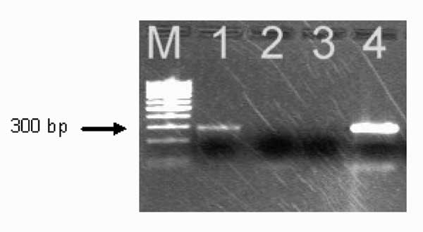 Polymerase chain reaction amplification of Anaplasma phagocytophilum DNA from the patient's acute-phase blood sample. Amplified DNA was separated by electrophoresis through the 2% agarose gel stained with ethidium bromide. Lane 1, patient sample (note the presence of the band at ≈293 bp); lane 2, negative sample; lane 3, negative control (no-DNA template control); lane 4 positive control (DNA extracted from the cultured isolate of A. phagocytophilum). Lane M represents a 100-bp DNA ladder for es