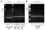 Thumbnail of Multiplex polymerase chain reaction (PCR) for pheromone fragment analysis. A) Multiplex PCR with 4 sets of primers comprising MFα1 (V190/V191) and MFa1 (V290/V291, V1311/V1312, V1313/V1314) genes were carried out as described in Materials and Methods. Approximately 100-bp MFα1 and 117-bp MFa1 PCR amlicons were detected on 3.5% MetaPhor agarose in Tris-borate-EDTA buffer for MATα and MATa strains comprising Cryptococcus neoformans var. grubii (CnVG), Cryptococcus neoformans var. neof