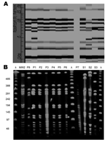Thumbnail of A) Ribotype and B) pulsed-field gel electrophoresis patterns of 8 clinical isolates of methicillin-resistant Staphylococcus aureus. Outbreak-related isolates P1–P7 are closely related to MW2. Clinical isolate P8 and the 3 isolates from healthcare workers (S1–S3) are unrelated to the outbreak strain.