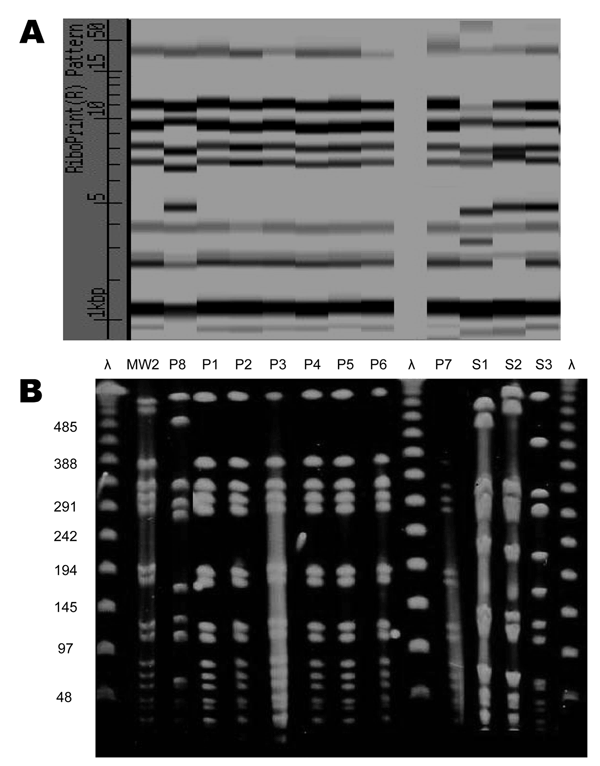 A) Ribotype and B) pulsed-field gel electrophoresis patterns of 8 clinical isolates of methicillin-resistant Staphylococcus aureus. Outbreak-related isolates P1–P7 are closely related to MW2. Clinical isolate P8 and the 3 isolates from healthcare workers (S1–S3) are unrelated to the outbreak strain.