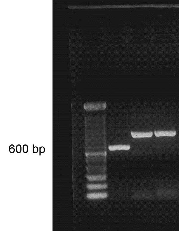 Polymerase chain reaction with ITS4/ITS5 primers: lane 1, ladder 100 bp; lane 2, positive control showing Pythium brasiliensis band at position 634 bp; lanes 3 and 4, P. insidiosum isolate B01 showing band at position ≈850 bp.