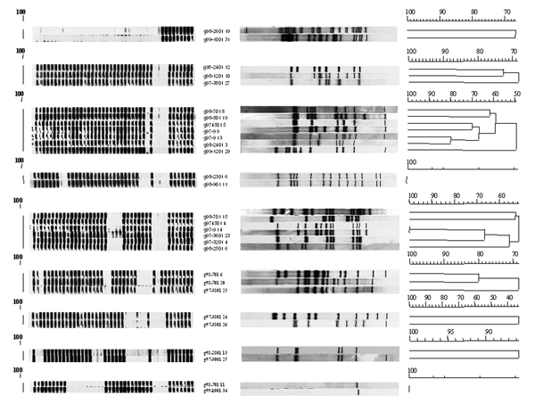 Spoligotype dendrograms generated by clustered Mycobacterium tuberculosis strains after computer analysis compared with the corresponding dendrograms of IS6110 DNA fingerprints.