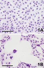 Thumbnail of Cytopathic effect (CPE) of Vero cells caused by Usutu virus infection, 4 days postinfection (hematoxylin-eosin staining). A) Uninfected control. B) Usutu virus infected; bar = 100 μm.