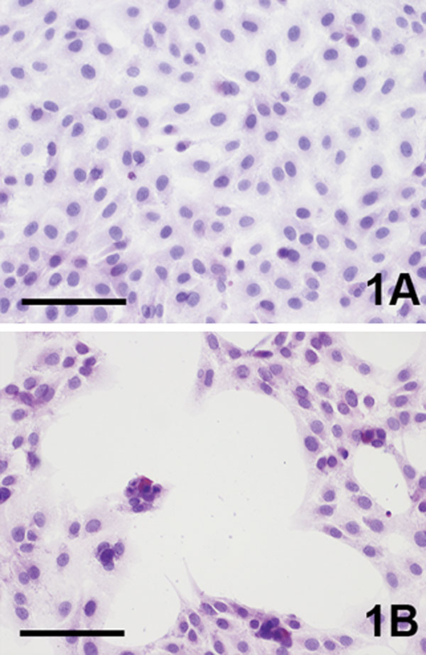 Cytopathic effect (CPE) of Vero cells caused by Usutu virus infection, 4 days postinfection (hematoxylin-eosin staining). A) Uninfected control. B) Usutu virus infected; bar = 100 μm.