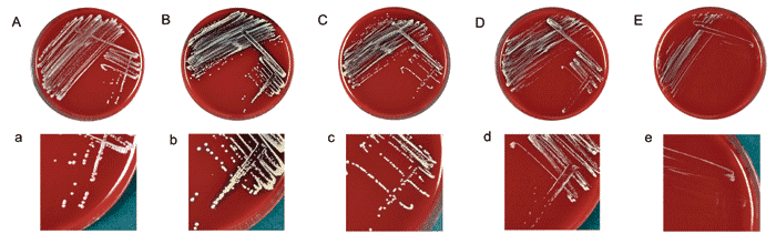 Sheep blood agar plates (A–E) and magnified sectors (a–e) after overnight incubation at 37°C showing different morphotypes of clonal isolates of the Staphylococcus lugdunensis strain recovered from blood cultures and the infected pocket of a patient with pacemaker infection. Plates A–D/a–d show S. lugdunensis colonies exhibiting the normal phenotype characterized by colonies of different diameter, ranging from 0.8 to 2.5 mm with creamy (A/a) or yellow (B–D/b–d) pigmentation and moderately heavy 