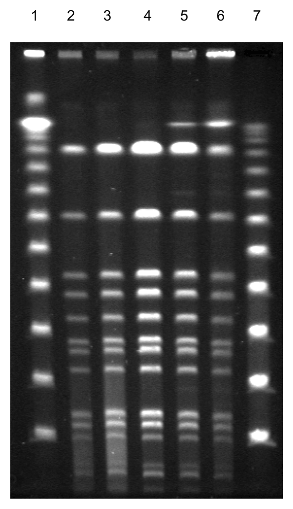 Fingerprint patterns for different Staphylococcus lugdunensis colony morphotypes, including small-colony variants (SCVs), after pulsed-field gel electrophoresis after digestion with SmaI, showing identical isolates. Lanes 1 and 7, 100-bp ladder; lane 2, blood isolate; lanes 3–5, colony variants; lane 6, SCVs of S. lugdunensis obtained from thrombotic material.