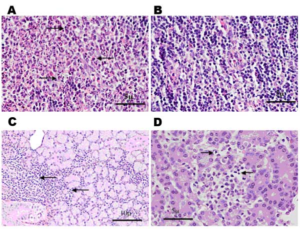 Histologic staining (hematoxylin and eosin) of spiny rat lymph nodes (A and B), salivary glands (C), and pancreas (D) after subcutaneous inoculation of 3 log10 PFU of Venezuelan equine encephalitis virus strain Co97-0054. A) Popliteal draining lymph node 24 h postinfection, showing the presence of a polymorphonuclear leukocyte infiltrate (arrows). B) Contralateral popliteal lymph node 24 hr postinfection from same animal. No proinfiltration was visible. C) Chronic inflammation of the salivary gl