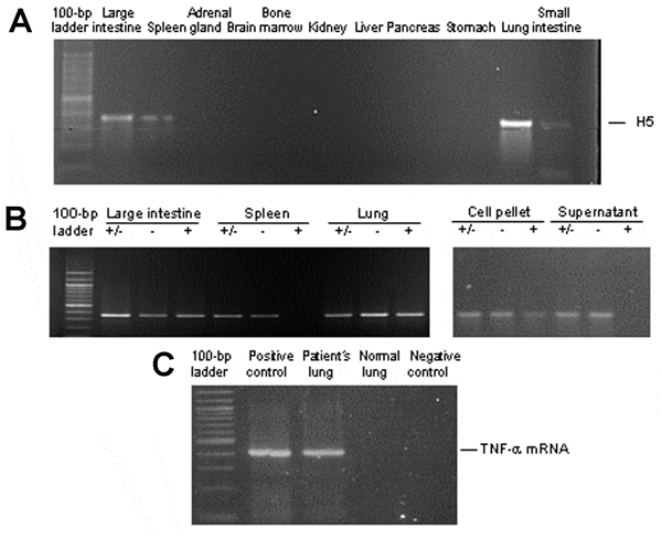 A) Detection of H5 influenza viral RNA in lungs, intestines, and spleen by reverse transcription-polymerase chain reaction (RT-PCR). B) Strand-specific RT-PCR detected positive-stranded viral RNA only in lungs and intestines but not in spleen. +/–, total RNA; –, negative-stranded RNA; +, positive-stranded RNA. RT-PCR products of an infected cell culture pellet and supernatant are shown as a control for proper amplification of the specific strands (lower panel). C) Tumor necrosis factor-α (TNF-α)