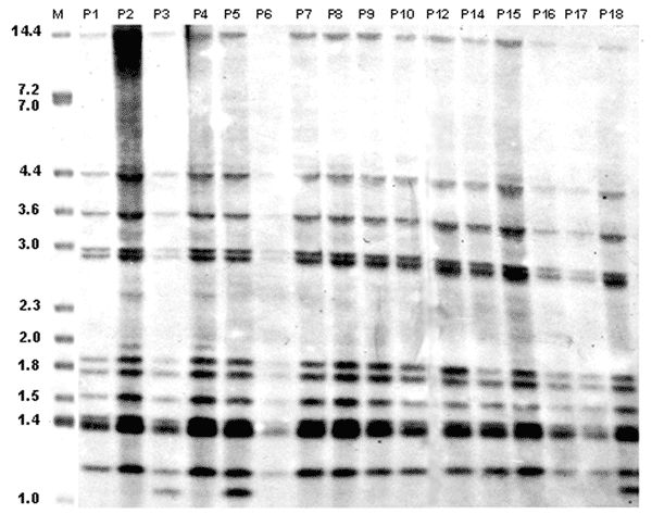 IS6110 restriction fragment length polymorphism (RFLP) analysis of Mycobacterium tuberculosis isolates from 16 patients associated with the multidrug-resistant tuberculosis outbreak, Bizerte, Tunisia, 2001–2004. Lane M, reference strain MTB14323. Values above each well correspond to each patient as identified in Table 1. Values on the left are in kilobases.