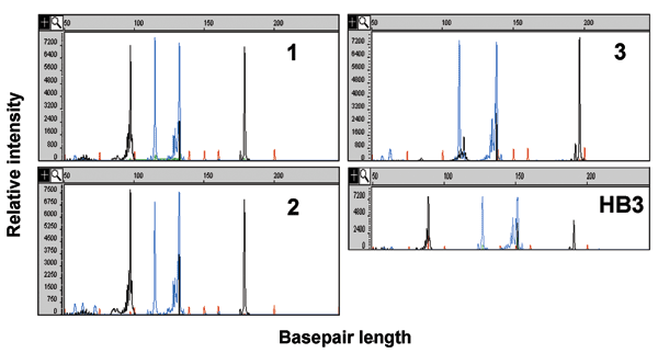 Capillary electropherograms of Plasmodium microsatellite analysis. The x axis represents fragment size in bases and the y axis represents fluorescence intensity. The P. falciparum microsatellites products C13M30 and PFPK (black peaks) and TA81 and C4M8 (blue peaks) from amplification genomic DNA from patients 1, 2, one of the unrelated patient controls, and control P. falciparum clone HB3. Each microsatellite has ≥10 alleles. Patients 1 and 2 have identical microsatellites at all 4 loci (Table).