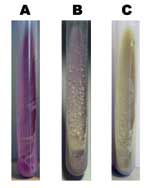 Thumbnail of Growth morphology on bromcresol purple medium of Mycobacterium bovis (A), M. tuberculosis (C), and 1 of the strains analyzed (B).
