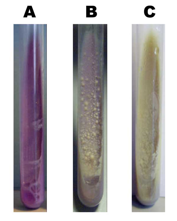 Growth morphology on bromcresol purple medium of Mycobacterium bovis (A), M. tuberculosis (C), and 1 of the strains analyzed (B).