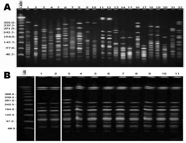 Pulsed-field gel electrophoresis of representative Acinetobacter strains. Twenty different clones (panel A) were recovered from cell phones (lanes no. 1, 3, 8–11) and hands of personnel (remaining lanes). Indistinguishable isolates were recovered from cellphones and hand cultures (lanes 11 and 12), and 2 hand cultures (lanes 18 and 19). Both pairs were obtained from different persons. Panel B shows a multidrug-resistant Acinetobacter spp. strain recovered from cell phones (lane 1), personnel han