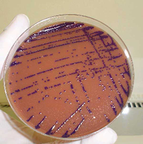 Colonies of Chromobacterium violaceum on a chocolate agar plate.