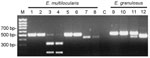 Thumbnail of Diagnostic polymerase chain reaction (PCR) restriction fragment length polymorphism analysis for Echinococcus multilocularis (lanes 1–8, 2 specimens in parallel) and E. granulosus (lanes 9–12, 1 specimen). Lane M: Gene Ruler 100-bp DNA ladder; lane C: negative control without DNA; lanes 1 and 2: amplification of E. multilocularis DNA with Eg9 PCR; lanes 3 and 4: amplification of E. multilocularis DNA with Eg9 PCR, followed by cleavage with enzyme CfoI; lanes 5 and 6: amplification o