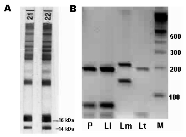 A) Immunoblot of the patient (strip no. 21) and the patient's mother (strip no. 22) showing specific antibodies against 14- and 16-kDa proteins of Leishmania infantum. B) restriction fragment length polymorphism patterns after HaeIII digestion of the ribosomal internal transcribed spacer 1 polymerase chain reaction products. P, patient; Li, L. infantum; Lm, L. major; Lt, L. tropica; M, 100-bp ladder.