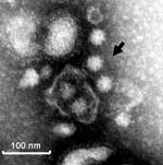 Thumbnail of Immune electron micrograph of porcine noroviruses (NoVs). The diluted intestinal contents of a gnotobiotic pig euthanized on postinoculation day 5 to QW101-like porcine NoVs (QW144) were incubated with convalescent-phase serum LL616 from another gnotobiotic pig inoculated with QW101-like porcine NoVs (QW126) and visualized by negative staining with 3% phosphotungstic acid. The arrow indicates a small clump of NoV-like particles.
