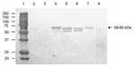 Thumbnail of Antigenic cross-reactivity between human genogroup (G) II norovirus (NoV) capsid proteins and a pig convalescent-phase antiserum (LL616) against porcine QW101-like (GII-18) NoV was determined by Western blot. The CsCl-gradient purified viruslike particles (1,250 ng) were separated by sodium dodecyl sulfate 10% polyacrylamide gel electrophoresis, blotted onto nitrocellulose membranes, and tested with LL616. The sucrose-cushion (40%, wt/vol) purified Sf9 insect cell proteins acted as 