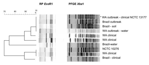 Molecular typing results for Burkholderia pseudomallei isolates from Brazil compared with Western Australian and reference isolates. The Unweighted Pair Group Method using arithmetic averages dendrogram on the left refers to the EcoR1 ribotype patterns in the center. XbaI DNA macrorestriction (pulsed-field gel electrophoresis, PFGE) patterns are shown at the right of the corresponding ribotypes for comparison. The ribotypes and PFGE types are each numbered from the first lane at the top of the f