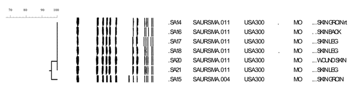 Dendrogram of the general relatedness (scale bar) of a sample of methicillin-resistant Staphylococcus aureus isolates based on pulsed-field gel electrophoresis of SmaI-digested DNA and comparisons of banding patterns using Dice similarity coefficients.