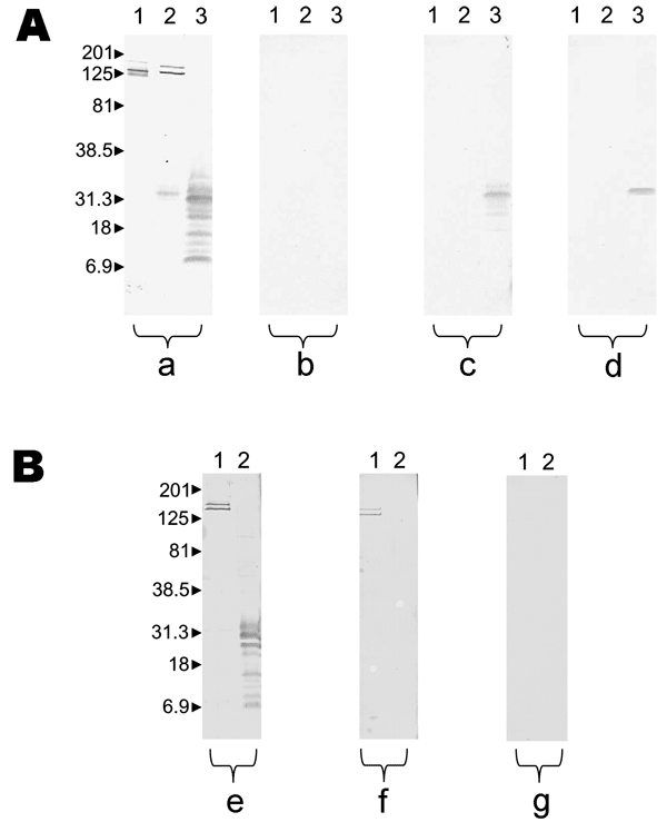 Results of Western blot performed with serum samples from patient 5 with Rickettsia felis infection and patient 10 with R. typhi infection. Molecular masses (in kilodaltons) are given to the left of panels. A) Patient with R. felis infection; a, untreated serum analyzed by using R. conorii (lane 1), R. typhi (lane 2), and R. felis (lane 3); b, R. felis–adsorbed serum analyzed by using R. conorii (lane 1), R. typhi (lane 2), R. felis (lane 3); all antibodies were removed; c, R. typhi–adsorbed ser