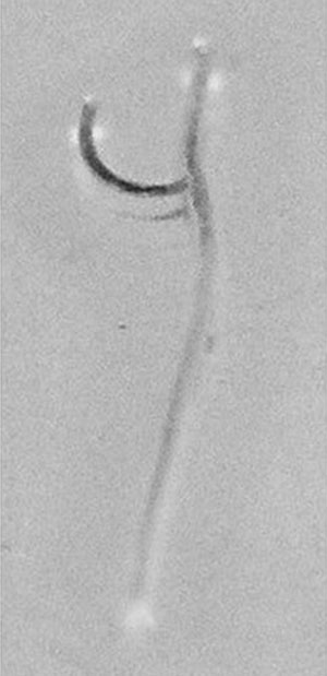 Male and female Mammonogamus laryngeus recovered from the bronchial mucosa.