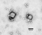 Thumbnail of Methylamine tungstate negative-stain electron micrograph of arenavirus isolated from mouse spleen homogenate cultures that tested positive by immunofluorescence assay for lymphocytic choriomeningitis virus infection. Viral envelope spikes and projections are visible, and virion inclusions show a sandy appearance, indicating Arenaviridae.