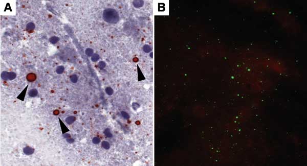 Touch impression of a rabies-positive Tanzanian domestic dog brain preserved in 50% glycerol saline solution for 15 months before testing by direct rapid immunohistochemical test (dRIT) and retested by direct fluorescent-antibody assay (DFA) after 5 months. A) Brain stained by dRIT: rabies virus antigen appears as magenta inclusions (arrowheads) against the blue neuronal hematoxylin counterstain. Magnification, ×630. B) Immunofluorescent apple-green viral inclusions in the same brain processed b