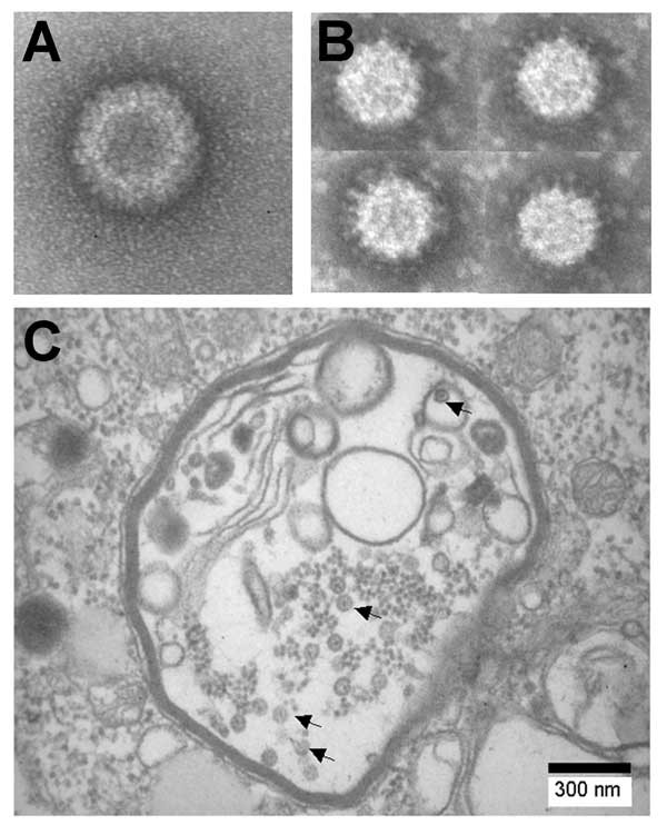 Negative contrast electron micrographs of A) Colorado tick fever virus and B) Banna virus (BAV). C) Thin section of BAV-infected C6/36 cells showing viral particles (arrows) in vacuolelike structures.