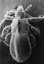 Thumbnail of Pediculus humanus corporis, the human body louse, viewed with electron microscope at magnification ×120.