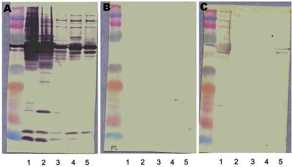 Western blot and cross-adsorption results in a patient with Bartonella quintana endocarditis. A) Nonadsorbed. B) Adsorbed with B. quintana. C) Adsorbed with B. henselae. Lane 1, B. quintana; lane 2, B. henselae; lane 3, B. elizabethae; lane 4, B. vinsonii subsp. Berkhoffi; lane 5, B. vinsonii subsp. Arupensis. Before adsorption (A), antibodies are detected against all species (1, 2, 3, 4, and 5). After adsorption with B. quintana antigen (B), all antibodies disappear. After adsorption with B. he