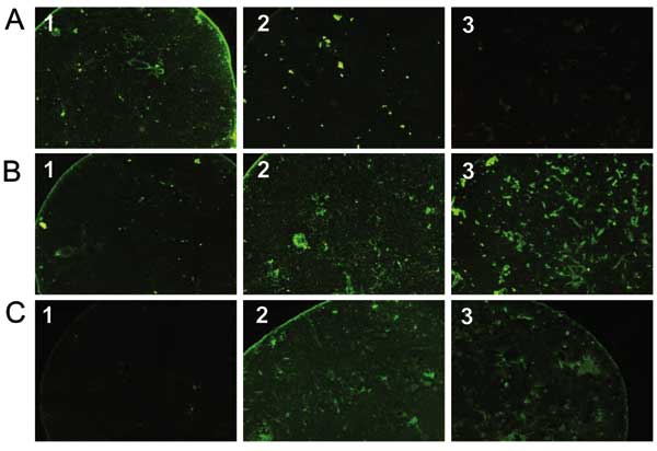 Pictures of immunofluorescence assay performed on serum specimens with proven Rickettsia conorii (A), R. felis (B), or R. typhi (C) infection showing cross-reactive antibodies. Antigens tested were R. conorii (column 1), R. felis (column 2), and R. typhi (column 3). The serum with R. conorii infection reacts with R. conorii and R. felis antigens but not with R. typhi (A). Conversely, the serum with R. typhi infection reacts with R. typhi and R. felis but not with R. conorii (C). Finally, the ser