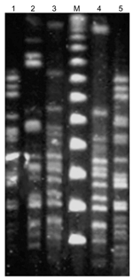 Thumbnail of Pulsed-field gel electrophoresis of ApaI-restricted genomic DNA of the 5 blaVIM-1-positive Acinetobacter baumannii isolates. The index numbers of the isolates are those listed in the Table. Lane M, molecular mass marker (48.5 kb).