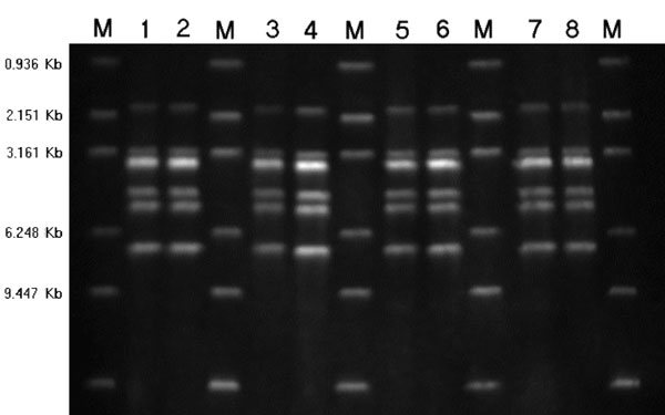 Figure 5. Ribotyping of Streptococcus suis serotype 2 isolates by PvuII restriction. Lane 1, deceased pig isolate SC5; lane 2, deceased pig isolate SC16; lane 3, patient isolate SC154; lane 4, patient isolate SC160; lane 5, patient isolate SC175; lane 6, patient isolate SC179; lane 7, patient isolate SC204; lane 8, patient isolate SC206; M, molecular size standard.