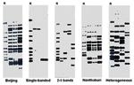 Thumbnail of IS6110 hybridization patterns of each Mycobacterium tuberculosis genotype. R indicates the M. tuberculosis Mt 14323 strain used as the positive control for IS6110 typing.