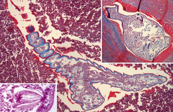 Linguatula serrata nymphs in lung tissue. Main panel shows the parasite's serrated nature and the cuticular spines (magnification ×200, Masson trichrome stain). Right upper inset, pulmonary nodule with prominent fibrotic reaction and shed cuticle around 1 nymph (magnification ×200, Masson trichrome stain). Left lower inset, detailed view of 1 parasite hook (magnification ×630, hematoxylin and eosin stain).