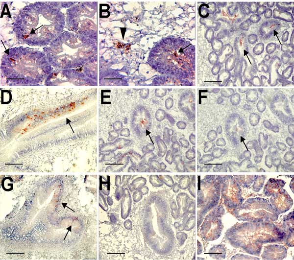 Immunohistochemical detection of Norwalk viruslike particles (VLPs) in oyster digestive tissue. A) VLPs in the digestive diverticulum 12 h after seeding sea water with 109 particles. The arrows show immunoreactivity detected in intraepithelial cells. B) VLPs in the digestive diverticulum 12 h after seeding sea water with 1012 particles. The arrowhead shows immunoreactivity in a phagocyte located in connective tissue, and the arrow shows immunoreactivity in the lumen of a digestive tubule. C) Att
