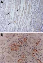 Thumbnail of Immunohistochemistry of an HPAI H5N1–infected white Cherry Valley duck (Anas platyrhynchos). The viral antigen is detected in myocardial cells and lymphoid cells (arrow) (A) and renal tubular cells (B) (magnification ×100). The primary antibody used for immunohistochemistry in this study was a mouse anti–avian influenza H5 antibody (Magellan Biotechnology, Chunan, Taiwan).