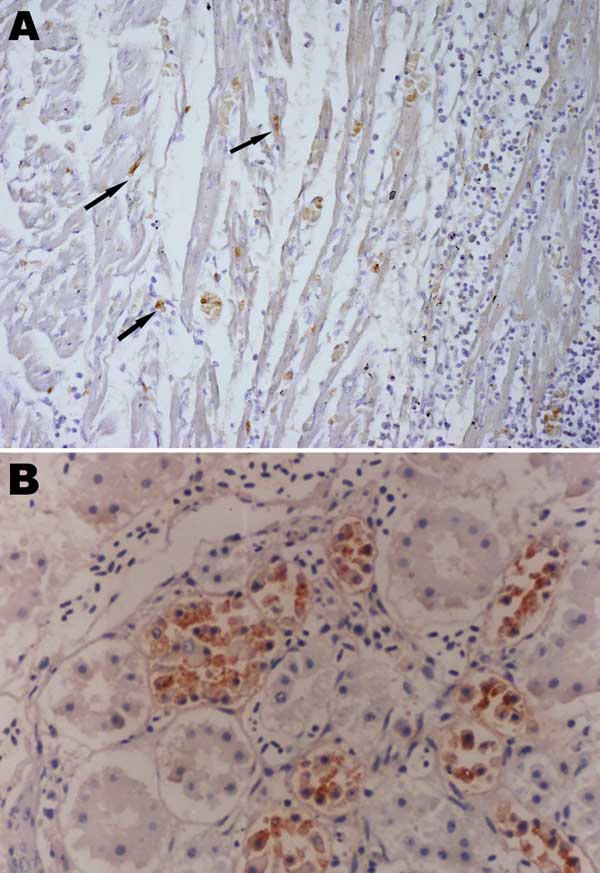 Immunohistochemistry of an HPAI H5N1–infected white Cherry Valley duck (Anas platyrhynchos). The viral antigen is detected in myocardial cells and lymphoid cells (arrow) (A) and renal tubular cells (B) (magnification ×100). The primary antibody used for immunohistochemistry in this study was a mouse anti–avian influenza H5 antibody (Magellan Biotechnology, Chunan, Taiwan).