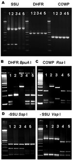 Thumbnail of Multilocus polymerase chain reaction–restriction fragment length polymorphism (PCR-RFLP) analysis of specimens previously identified as Cryptosporidium canis and C. felis. A) Agarose gel electrophoresis of PCR-amplified products of specimens previously identified as C. canis (lanes 1–3) and C. felis (lanes 4 and 5) with molecular tools based on the small subunit (SSU) rRNA, dihydrofolate reductase (DHFR), and Cryptosporidium oocyst wall protein (COWP). Molecular markers in all photo