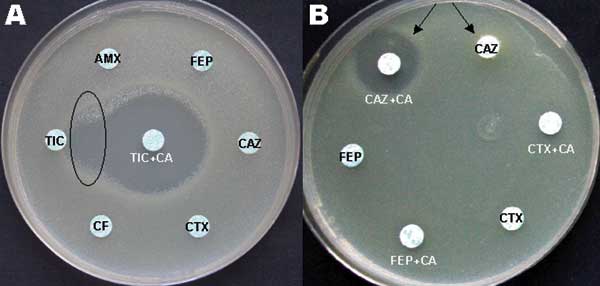 A) Oval indicates area of synergy between ticarcillin (TIC) and TIC plus clavulanic acid (CA). B) Arrows point to inhibition zone around third-generation disks with and without CA. AMX, amoxicillin; FEP, cefepime; CAZ, ceftazidime; CTX, cefotaxime; CF, cefalotin.
