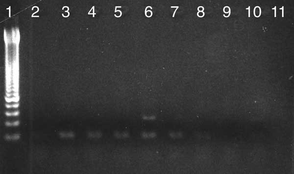PCR amplification of a 120-bp fragment of kinetoplastid mitochondrial DNA of Leishmania spp. in Egyptian and Nubian mummies. Lane 1, 50-bp ladder lanes 2–8, mummy samples; lanes 9,10, extraction controls; lane 11, PCR controls. Lane 6 provides a positive amplification product of the expected size.