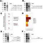 Thumbnail of Figure 1&nbsp;-&nbsp;Atypical scrapie and Nor98 isolates PrPres Western blot pattern. Western blot (WB) profile in atypical (A, lane 2) and classic (B, lane 3) scrapie isolates with curves of chemiluminescence measured along the lane and corresponding apparent MWs (MWs), assessed by Bio-Rad Quantity One software analysis after signal capture using Versa Doc5000. Molecular weight (MW) standard (lanes 1). WB profiles of French atypical isolates in sheep (n = 17) and goats (n = 2) were