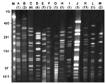 Thumbnail of Pulsed-field gel electrophoresis (PFGE) types of 47 isolates of serotype 6B, serotype 3, and serotype 18C. Numbers in parentheses indicate the total number of isolates belonging to each PFGE type. Lane M, λ ladder; lanes A–J, 10 PFGE types found among 23 isolates of serotype 6B; lane K, 1 PFGE type found among 11 isolates of serotype 3; lanes L–M, 2 PFGE types found among 3 isolates of serotype 18C.