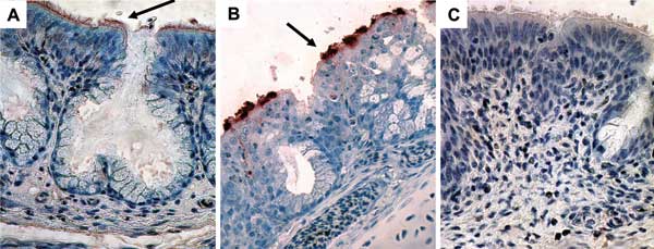 Immunohistochemical findings for nasal turbinates, showing peroxidase staining of viral antigen in the epithelial surface (magnification ×400; arrows). A) Turkey poults exposed to human metapneumovirus (hMPV B2). B) Turkey poults exposed to avian metapneumovirus (aMPV C). C) Sham-inoculated turkey poults.