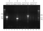 Thumbnail of PCR analysis determining the genotype of enterotoxin gene–carrying Clostridium perfringens type A isolates obtained from healthy persons. All 4 strains are studied with 3 different primer sets, described in Table 1. For A, B, C and D, the isolate represents genotype IS1470-like-cpe, IS1151-cpe, IS1470-cpe, or unknown genotype, respectively.