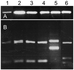 Thumbnail of A) PCR of Leishmania internal transcribed spacer region 1 (ITS1) of naturally infected Phlebotomus sergenti sand flies and cultured Leishmania spp. controls. B) HaeIII digestion of restriction fragment length polymorphisms of ITS1 PCR products shown in A. Lane 1, P. sergenti female 1; lane 2, P. sergenti female 2; lane 3, P. sergenti female 3; lane 4, L. tropica (Lt-L590); lane 5, L. major (Lm-L777); lane 6, L. infantum (Li-L699).