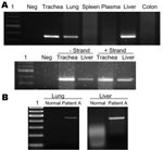Thumbnail of A) Detection of viral RNA in lung, trachea, and liver by reverse transcription–PCR (RT-PCR) (upper panel) and detection of positive- and negative-stranded viral RNA in trachea and liver by strand-specific RT-PCR (lower panel). Lane 1, 100-bp ladder; Neg, negative. B) RT-PCR showing overexpression of tumor necrosis factor-α in lung and liver tissues of patient in A compared with normal tissues.